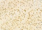 HEATR1 Antibody in Immunohistochemistry (Paraffin) (IHC (P))