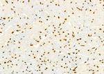 HEATR1 Antibody in Immunohistochemistry (Paraffin) (IHC (P))