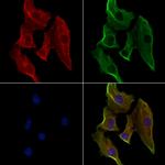 HLA-DMB Antibody in Immunocytochemistry (ICC/IF)