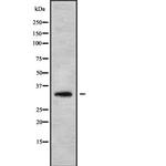 HOXB1 Antibody in Western Blot (WB)