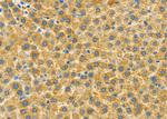 IMMP2L Antibody in Immunohistochemistry (Paraffin) (IHC (P))