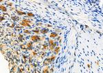 MUC5B Antibody in Immunohistochemistry (Paraffin) (IHC (P))