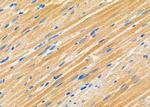 MYO6 Antibody in Immunohistochemistry (Paraffin) (IHC (P))