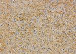 NDUFB7 Antibody in Immunohistochemistry (Paraffin) (IHC (P))