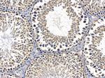 NKp44 Antibody in Immunohistochemistry (Paraffin) (IHC (P))