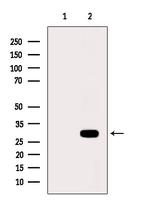 NKp44 Antibody in Western Blot (WB)