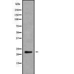 Neurensin 2 Antibody in Western Blot (WB)