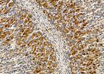 NBPF6 Antibody in Immunohistochemistry (Paraffin) (IHC (P))