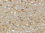 NAV2 Antibody in Immunohistochemistry (Paraffin) (IHC (P))