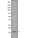 TNP2 Antibody in Western Blot (WB)