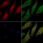 NOP14 Antibody in Immunocytochemistry (ICC/IF)