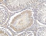 NOL9 Antibody in Immunohistochemistry (Paraffin) (IHC (P))