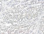 ZCCHC17 Antibody in Immunohistochemistry (Paraffin) (IHC (P))