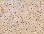 ZCCHC17 Antibody in Immunohistochemistry (Paraffin) (IHC (P))