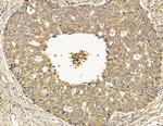 INPP5J Antibody in Immunohistochemistry (Paraffin) (IHC (P))