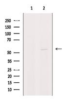 PIGA Antibody in Western Blot (WB)