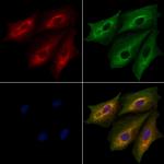 PITPN Antibody in Immunocytochemistry (ICC/IF)