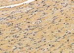 PIGW Antibody in Immunohistochemistry (Paraffin) (IHC (P))