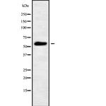 PIGW Antibody in Western Blot (WB)