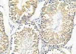 PABPC4 Antibody in Immunohistochemistry (Paraffin) (IHC (P))