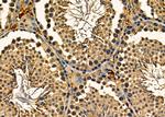 APOBEC3A/APOBEC3B Antibody in Immunohistochemistry (Paraffin) (IHC (P))