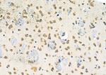 PPP1R1C Antibody in Immunohistochemistry (Paraffin) (IHC (P))