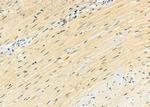 PPP1R3D Antibody in Immunohistochemistry (Paraffin) (IHC (P))