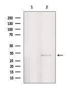 PPP1R3D Antibody in Western Blot (WB)