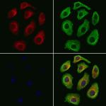 S100A7 Antibody in Immunocytochemistry (ICC/IF)