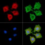 RABL2B Antibody in Immunocytochemistry (ICC/IF)