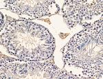 RABL2B Antibody in Immunohistochemistry (Paraffin) (IHC (P))