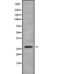 RABL2B Antibody in Western Blot (WB)