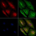 RAB15 Antibody in Immunocytochemistry (ICC/IF)