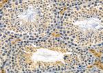 RAB15 Antibody in Immunohistochemistry (Paraffin) (IHC (P))