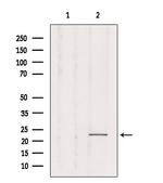 RAB1B Antibody in Western Blot (WB)