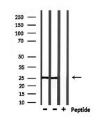 RAB28 Antibody in Western Blot (WB)