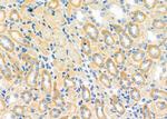 RAB32 Antibody in Immunohistochemistry (Paraffin) (IHC (P))