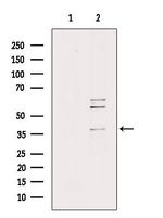 RAB39A Antibody in Western Blot (WB)