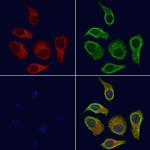 RAB39B Antibody in Immunocytochemistry (ICC/IF)