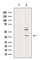 RAB39B Antibody in Western Blot (WB)