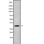 RAB40AL Antibody in Western Blot (WB)