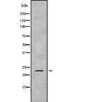 RAB43 Antibody in Western Blot (WB)