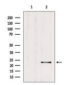 RAB9B Antibody in Western Blot (WB)