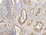 RRAS2 Antibody in Immunohistochemistry (Paraffin) (IHC (P))