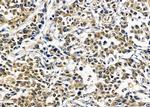 RGS20 Antibody in Immunohistochemistry (Paraffin) (IHC (P))