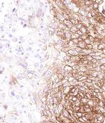 ABCA4 Antibody in Immunohistochemistry (Paraffin) (IHC (P))