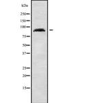 ARHGAP24 Antibody in Western Blot (WB)