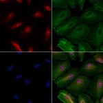 BMS1 Antibody in Immunocytochemistry (ICC/IF)