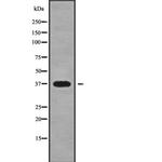 SRR Antibody in Western Blot (WB)