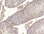 SCML2 Antibody in Immunohistochemistry (Paraffin) (IHC (P))